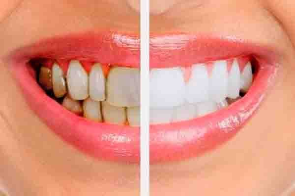 Periodoncia y Cirugía Mucogingival